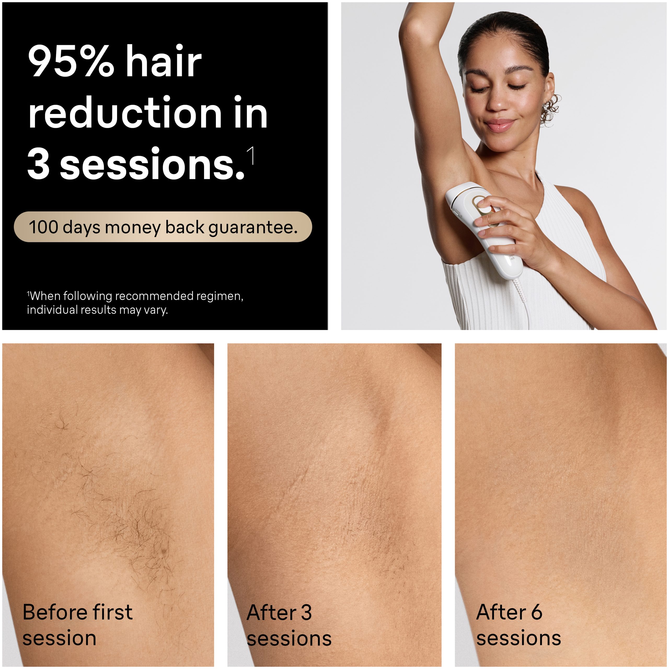Braun Smart IPL, Silk Expert Pro 5: At Home Alternative to Laser Hair Removal with 4 Caps, Facial Hair Trimmer, and Vanity Case, IPL5442 - Image 2