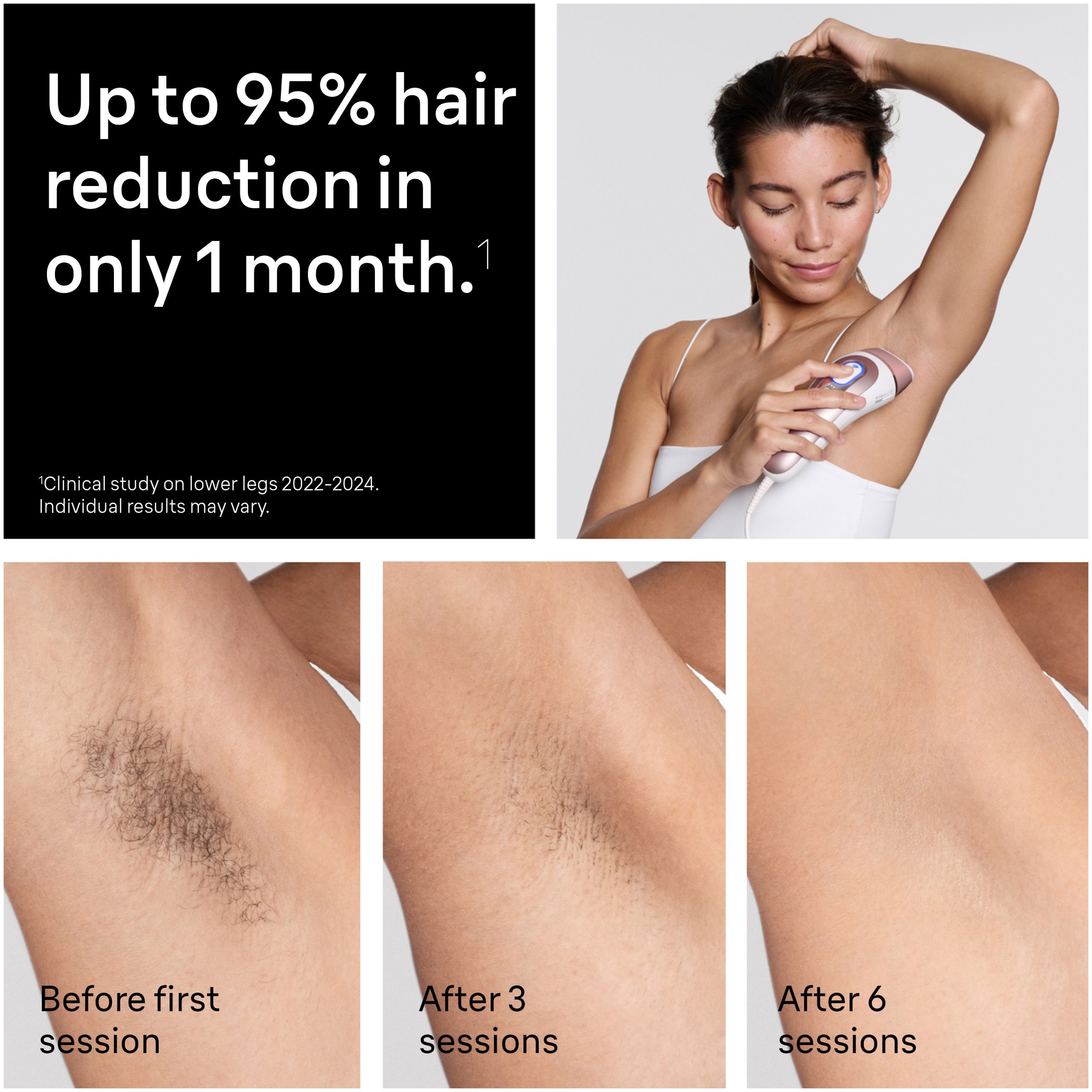 Braun Skin iexpert Smart IPL: At Home Alternative to Laser Hair Removal with 3 Caps and Leather Pouch, PL7243 - Image 4